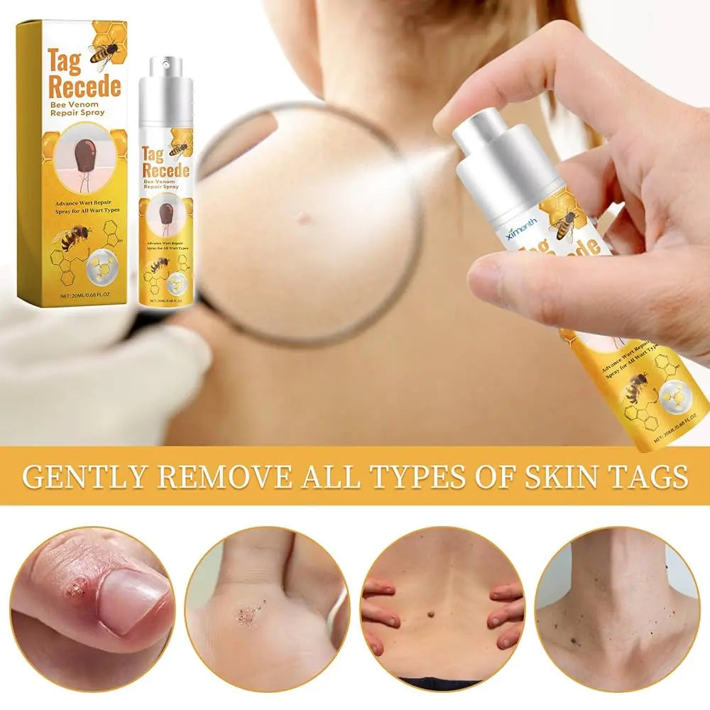 ✨Spray TagRecede 🌿Tratamiento Para la Eliminación de Verrugas🌿