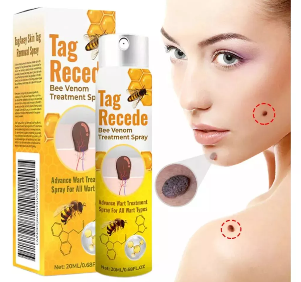 ✨Spray TagRecede Tratamiento Para la Eliminación de Verrugas🌿