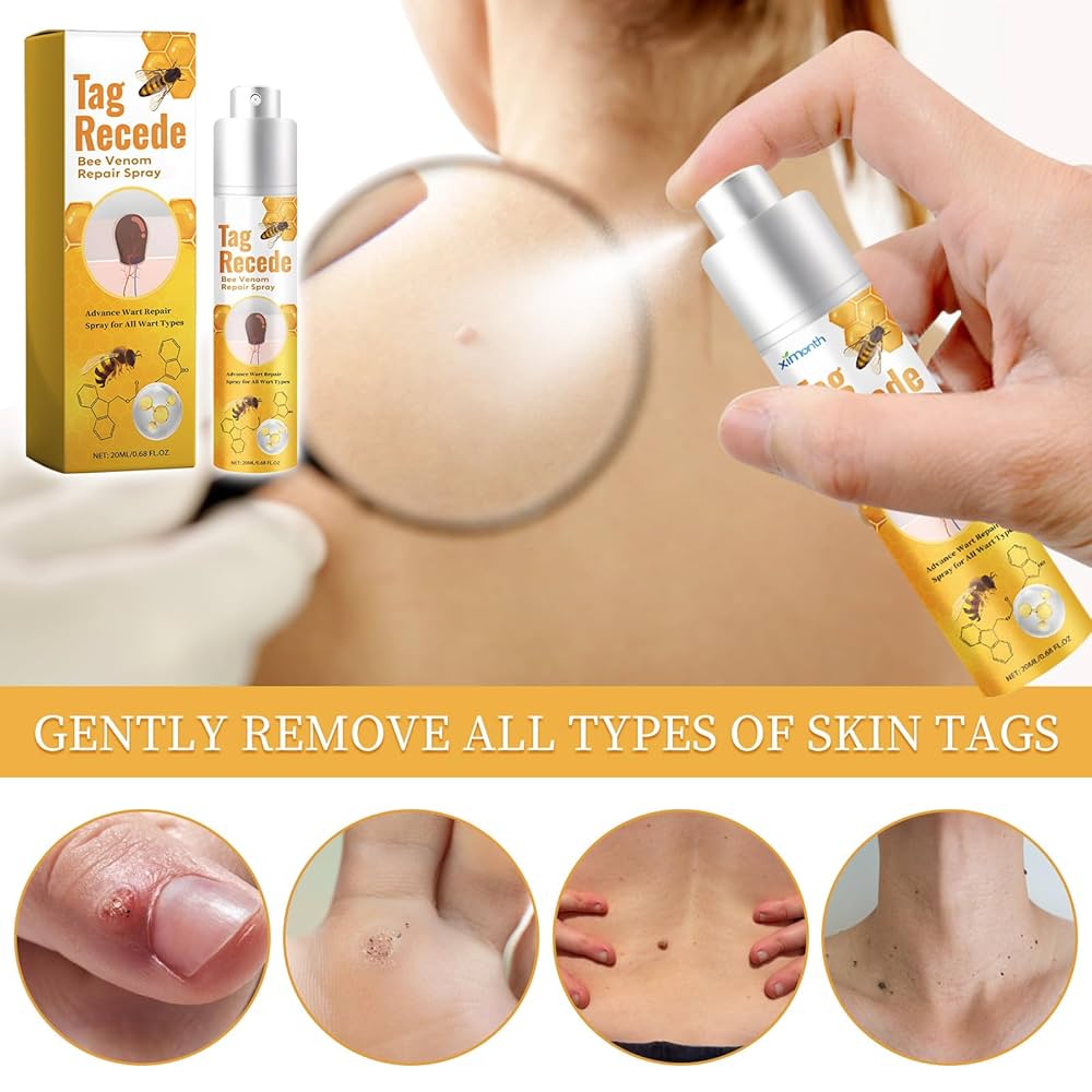 ✨Spray TagRecede Tratamiento Para la Eliminación de Verrugas🌿