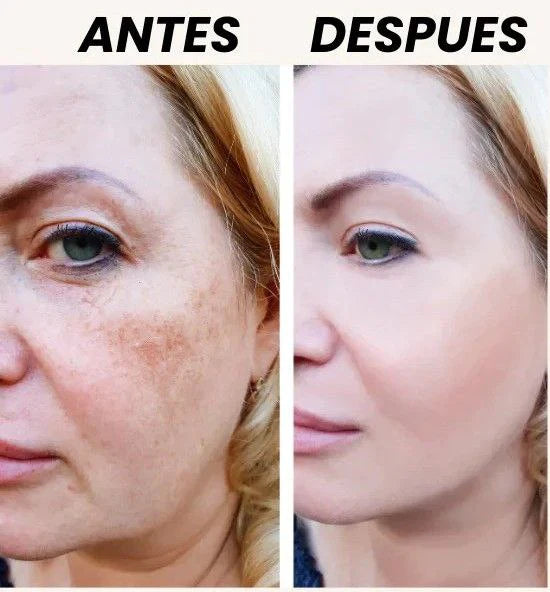 😍Paga 1 - Lleva 2🎁 Zamia Crema Aclarante✨ Despídete de las manchas🌸