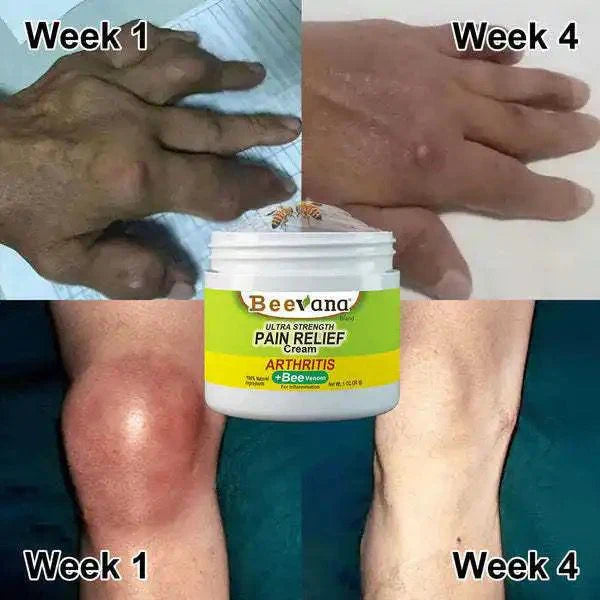 ✨BEEVANA CREMA PARA TERAPIA DE HUESOS Y ARTICULACIONES