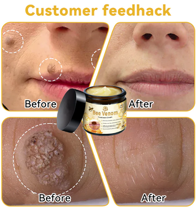 😍Paga 1 - Lleva 2🎁 🌿Bee Venom Cream ✨Potencia tu belleza desde la raíz