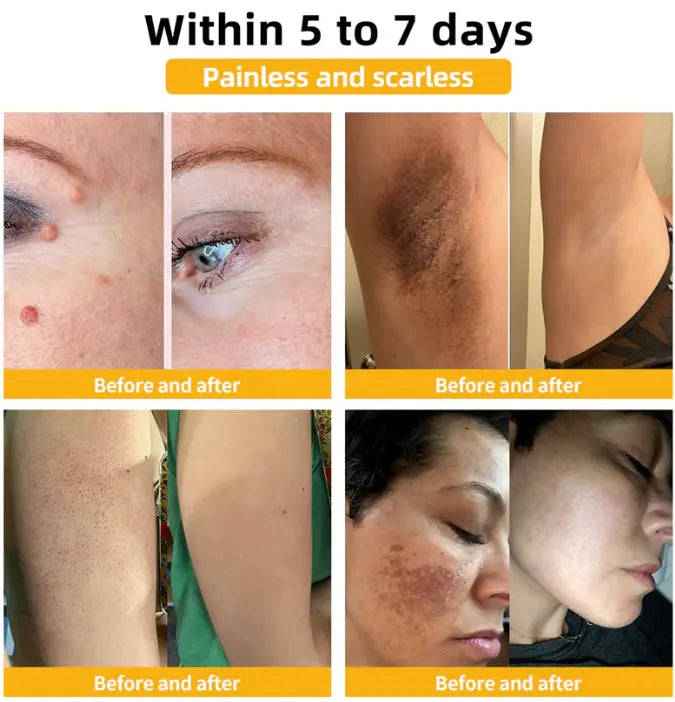😍Paga 1 - Lleva 2🎁 ✨ Renueva tu piel de manera natural con 🌿Bee Venom ✨