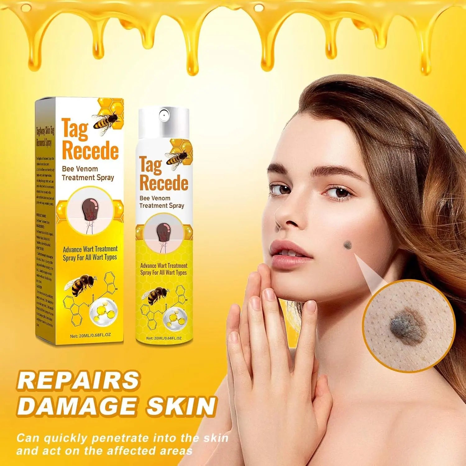 ✨Spray TagRecede 🌿Tratamiento Para la Eliminación de Verrugas🌿